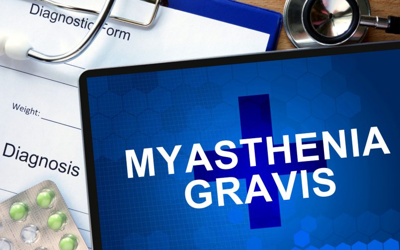 Myasthenia-Gravis-805x503